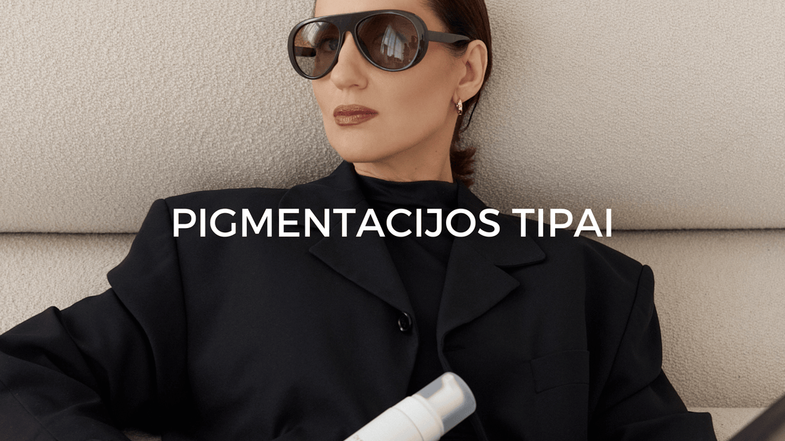 Pigmentacijos tipai ir kaip juos atskirti