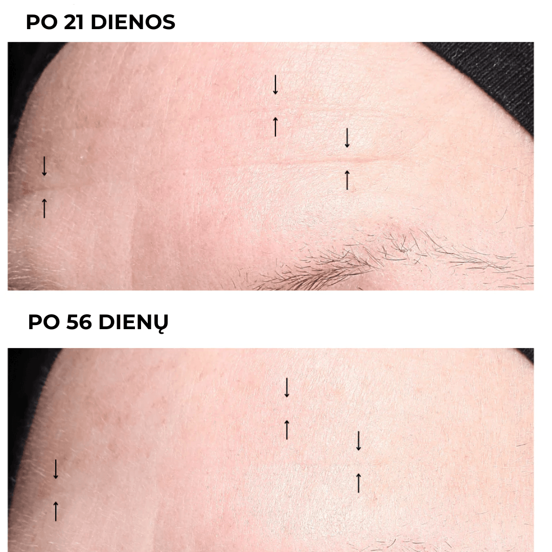 Intensyvus naktinis veido kremas INTENSE NIGHT CREAM