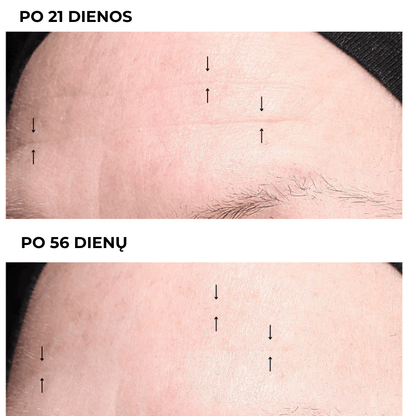 Intensyvus naktinis veido kremas INTENSE NIGHT CREAM