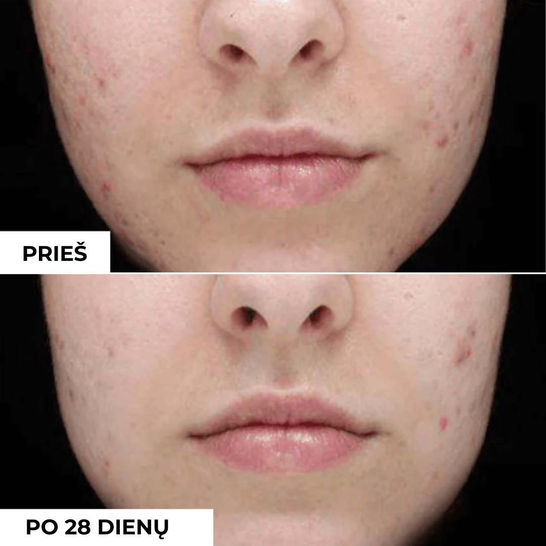 Veido prausiklis su salicilo rugštimi PURIFYING CLEANSING GEL